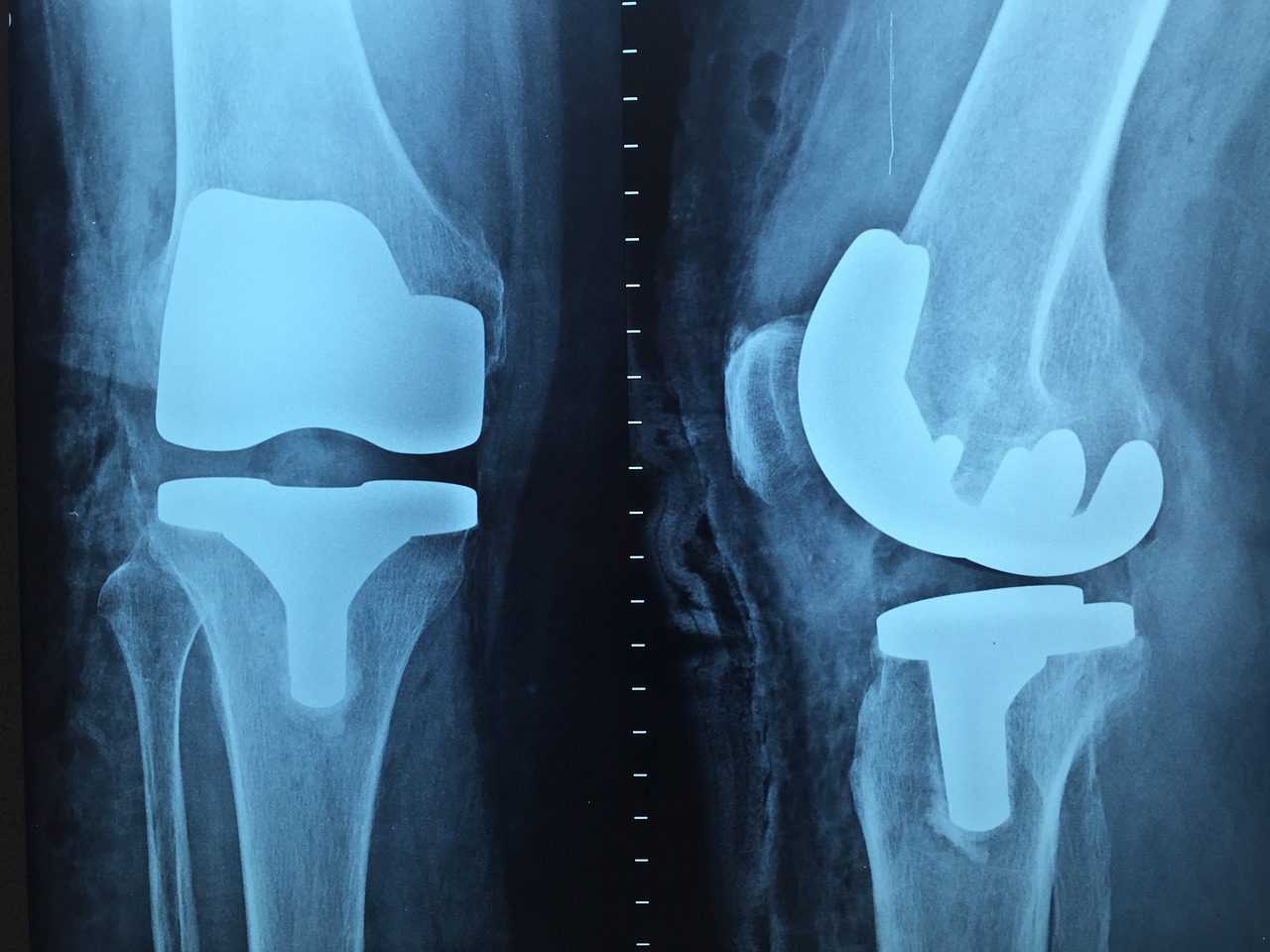 Kiedy najczęściej zgłaszamy się do ortopedy?